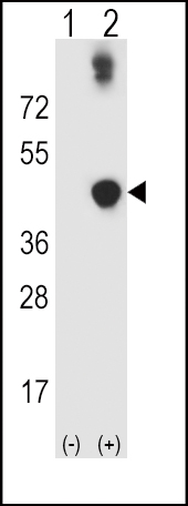 1 - ADH5 Antibody (Center) AP8562C