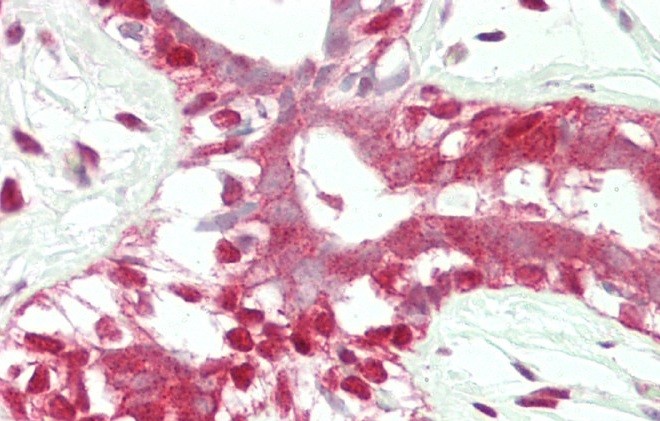 14 - ADH5 Antibody (Center) AP8562C