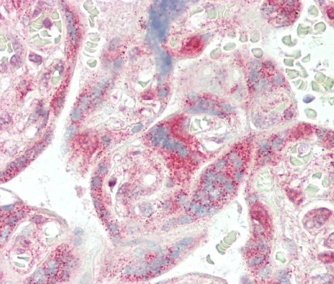 14 - ADH5 Antibody (Center) AP8562C