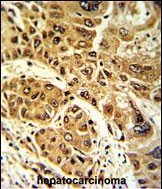 14 - LPIN2 Antibody (Center) AP8583c