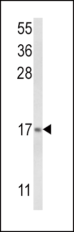 1 - LTC4S Antibody (N-term) AP8584a