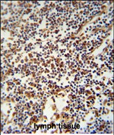 14 - USF2 Antibody (Center) AP8585c