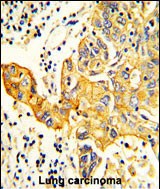 14 - RARS2 Antibody (C-term) AP8590b