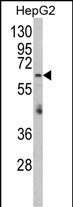 1 - RARS2 Antibody (C-term) AP8590b