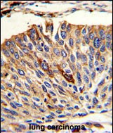 14 - VTI1A Antibody (C-term) AP8602b