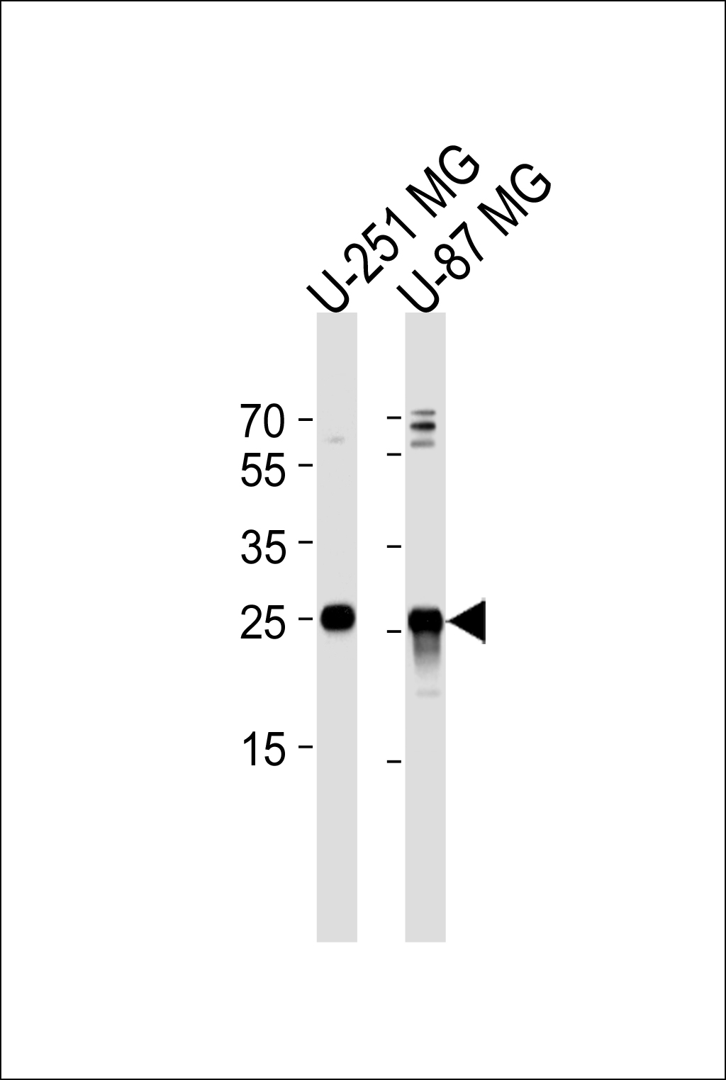 1 - VTI1A Antibody (C-term) AP8602b