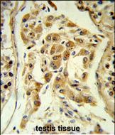 14 - ESPN Antibody (N-term) AP6876a