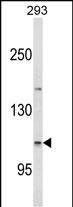 1 - ESPN Antibody (N-term) AP6876a
