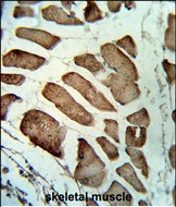 14 - LMOD1 Antibody (Center N201) AP8611c