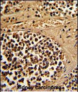 14 - ESRRA Antibody (Center) AP8635c