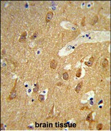 14 - TSPAN12 Antibody (C-term) AP8693b