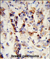 14 - SKIV2L2 Antibody (Center) AP8739c
