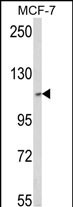 1 - SKIV2L2 Antibody (Center) AP8739c