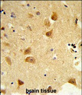14 - DERL1 Antibody (C-term) AP8745b