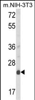 1 - DERL1 Antibody (C-term) AP8745b
