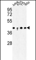 1 - CANT1 Antibody (N-term) AP8822a