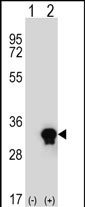 1 - C1QTNF6 Antibody (N-term) AP8883a