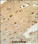 14 - GAL3ST1 Antibody (Center) AP8884c