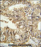 14 - GPA33 Antibody (C-term) AP8888B