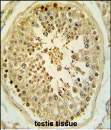 14 - LMX1B Antibody (Center) AP8935c