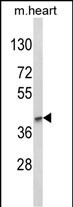 1 - LMX1B Antibody (Center) AP8935c