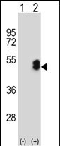 1 - LMX1B Antibody (Center) AP8935c
