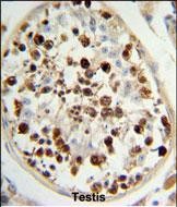 14 - C13orf3 Antibody (Center) AP8979c