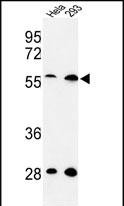 1 - C13orf3 Antibody (Center) AP8979c