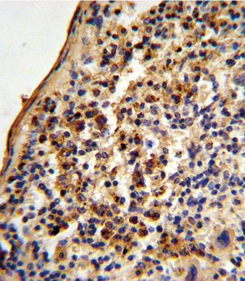 14 - Ku70 Antibody (Center) AP6775c