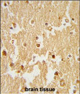14 - ESRRB Antibody (Center) AP9061c