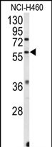 1 - ESRRB Antibody (Center) AP9061c