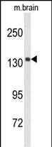 1 - UTY Antibody (C-term) AP9074b