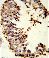 14 - ACR Antibody (Center) AP9079c