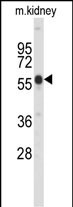 1 - Park6(PINK1) Antibody(C-term) AP6406D