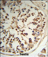14 - TPK1 Antibody (N-term) AP9142A