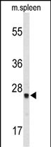 1 - TPK1 Antibody (N-term) AP9142A