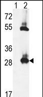 1 - TPK1 Antibody (N-term) AP9142A