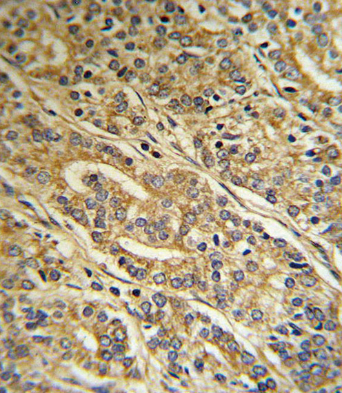 14 - ACOT8 Antibody (C-term) AP9144b