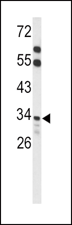 1 - ACOT8 Antibody (C-term) AP9144b