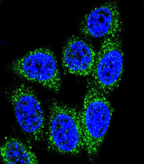 3 - MUTYH Antibody (Center) AP9161c