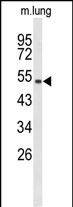 1 - MUTYH Antibody (Center) AP9161c