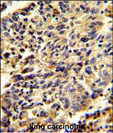 14 - Glypican-1 Antibody (N-term) AP9163A