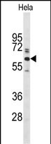 1 - Glypican-1 Antibody (N-term) AP9163A
