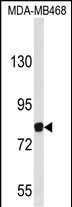 1 - EVI5 Antibody (Center) AP9168c