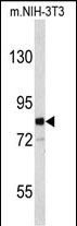 1 - EVI5 Antibody (Center) AP9168c