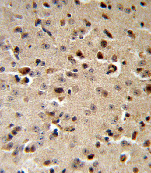 14 - TPH2 Antibody (Center) AP9177C