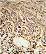 14 - EIF4A2 Antibody (C-term) AP9190B