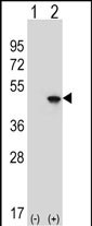 1 - EIF4A2 Antibody (C-term) AP9190B