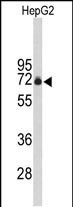 1 - FBXO3 Antibody (C-term) AP9195b