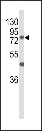 1 - GALNT3 Antibody (Center) AP9208C